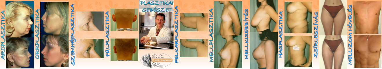 plasztikai_sebeszet_mutetek_633_20100824123405_387.jpg
