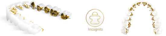 incognito_502_20081203125905_263.JPG