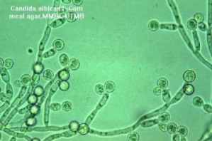 candida1_636_2011032290833_608.jpg