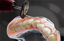 ALLERGIA MENTES FOGSOR