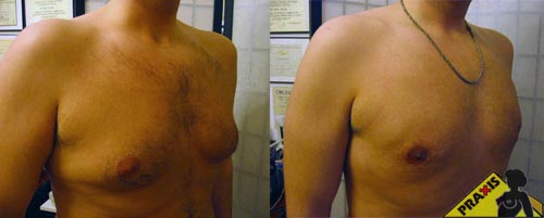 Praxis Plasztikai Sebészet - ajakfeltöltés, anyajegy eltávolítás, arcplasztika, botox kezelés, felkarplasztika,