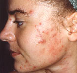 Gyógynövényes mélyhámlasztás,Dermanutrics termékcsalád,Nappali és éjszakai krémek,Villanófényes szőrtelenítés