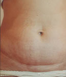 Gyógynövényes mélyhámlasztás,Dermanutrics termékcsalád,Nappali és éjszakai krémek,Villanófényes szőrtelenítés