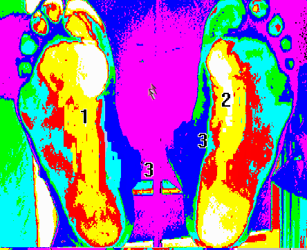 szamitogepes_labvizsgalat_282_20110609115559_59.gif