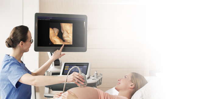3D és 4D ultrahang készülék - Accuvix A30