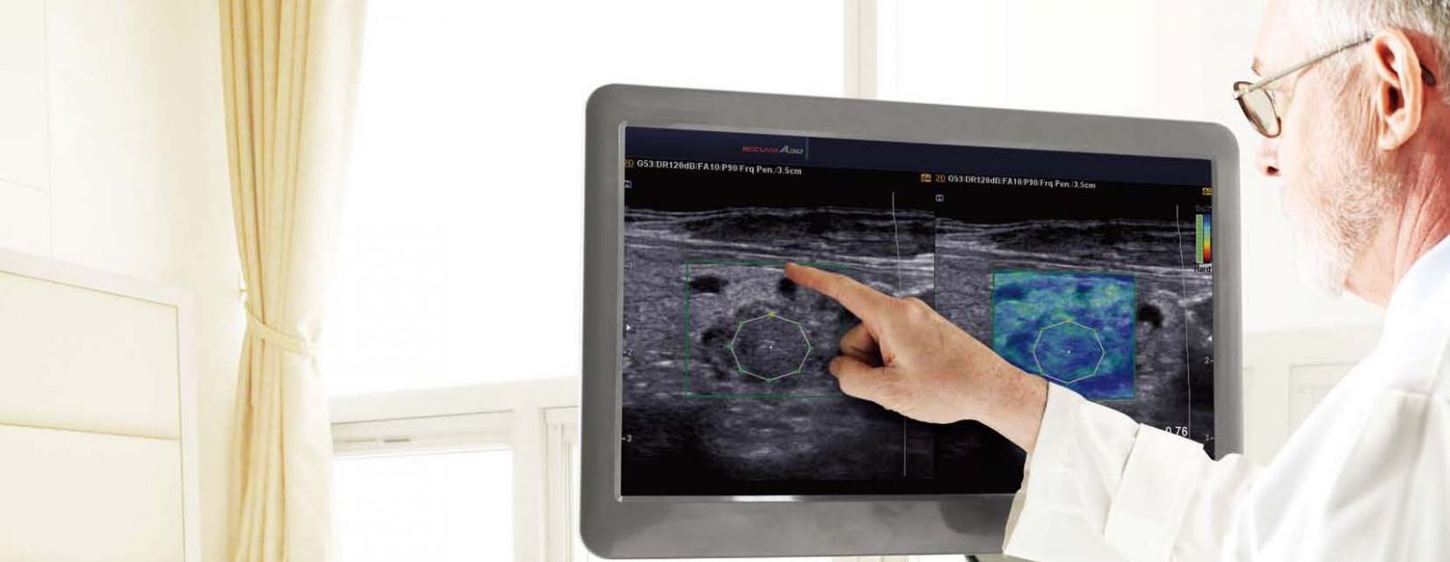 Accuvix A30 ultrahang készülék