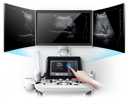 Digit&aacute;lis TGC-&aacute;ll&iacute;t&aacute;s