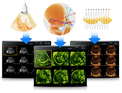 3D eXtended Imaging  (3D XI)